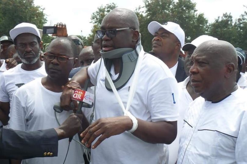 Fayose-on-neck-braces-after-teargas-experience.jpg