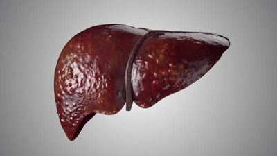 Nigeria’s quest for Liver Transplant